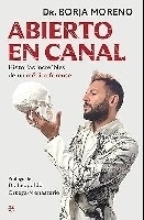Abierto en canal